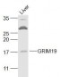 GRIM19 Polyclonal Antibody