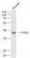 PHD2 Polyclonal Antibody