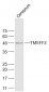 TMEFF2 Polyclonal Antibody