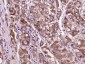 TMEFF2 Polyclonal Antibody