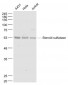 Steroid sulfatase Polyclonal Antibody