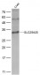 SLC25A20 Polyclonal Antibody