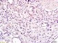 CHMP1A Polyclonal Antibody