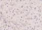 CHMP1A Polyclonal Antibody