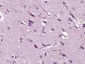 ARHGAP20 Polyclonal Antibody