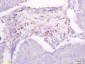 DBC2 Polyclonal Antibody