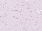 CD30 Polyclonal Antibody