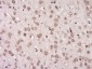 AGPAT1 Polyclonal Antibody