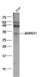 AGPAT1 Polyclonal Antibody