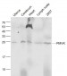 PMVK Polyclonal Antibody