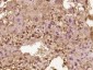 MBNL3 Polyclonal Antibody