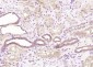 TACC2 Polyclonal Antibody