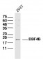 DBF4B Polyclonal Antibody