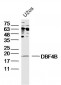 DBF4B Polyclonal Antibody