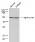 HEPACAM Polyclonal Antibody