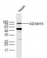 ADAM18 Polyclonal Antibody