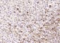 KLK15 Polyclonal Antibody