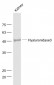 Hyaluronidase3 Polyclonal Antibody