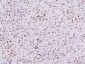 KLHL7 Polyclonal Antibody