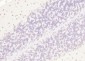 KLHL7 Polyclonal Antibody