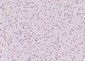 NARG2 Polyclonal Antibody