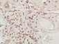 AARE Polyclonal Antibody