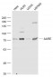 AARE Polyclonal Antibody