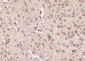 FBXO31 Polyclonal Antibody