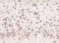 RSRC2 Polyclonal Antibody