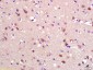 RASGEF1A Polyclonal Antibody