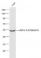 Alpha 2 antiplasmin  Polyclonal Antibody