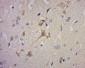 PRR11 Polyclonal Antibody