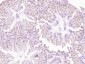 TKTL1 Polyclonal Antibody