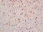 BRD8 Polyclonal Antibody