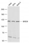 BRD8 Polyclonal Antibody