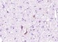 Ryanodine Receptor Polyclonal Antibody