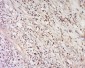 IFNA16/Interferon alpha 16 Polyclonal Antibody