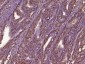 Epithelial Stromal Interaction 1 Polyclonal Antibody