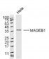 MAGEB1 Polyclonal Antibody