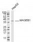 MAGEB1 Polyclonal Antibody