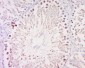 MAGEB3 Polyclonal Antibody