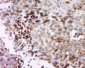 MAGEB3 Polyclonal Antibody