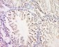 MAGEB3 Polyclonal Antibody