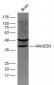 MAGEB3 Polyclonal Antibody