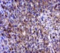 MAGEB6 Polyclonal Antibody