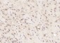 OCIAD1 Polyclonal Antibody