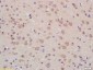 PMPCB Polyclonal Antibody