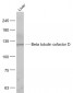 Beta tubulin cofactor D Polyclonal Antibody