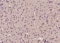 BTBD3 Polyclonal Antibody