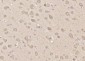 FAM96B Polyclonal Antibody